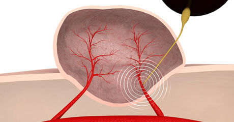 Ein Segelboot auf dem Wasser
